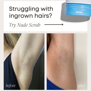 NUDE Ingrown Hair Scrub with Blue Packaging